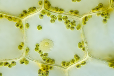 Cellule d'Elodée exposée à la lumière - mise en évidence de la synthèse d'amidon - test à l'eau iodée x200